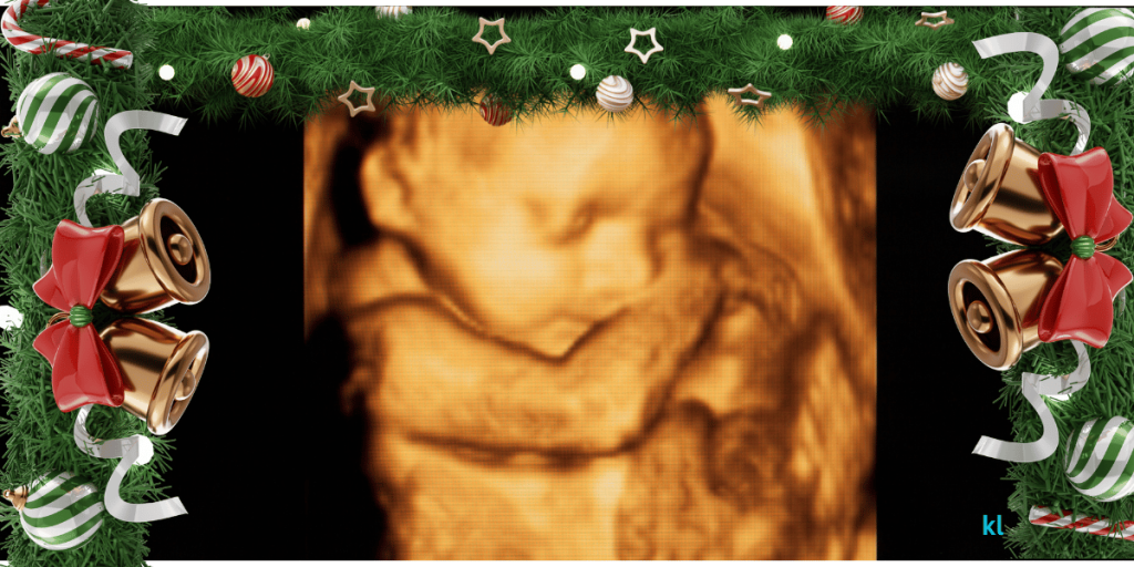 10 Creative Ways to Mark Pregnancy Milestones at Christmas