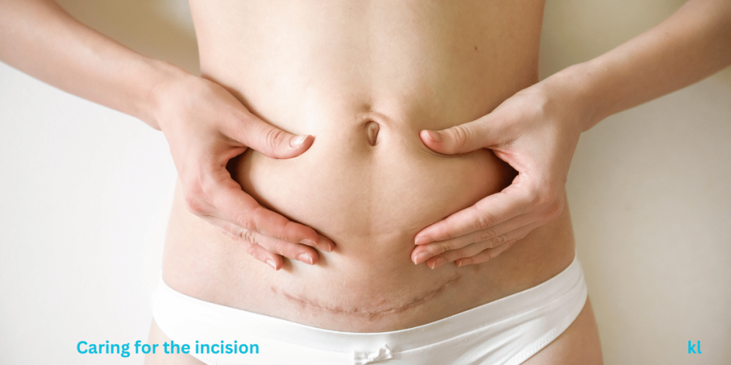 Vaginal Birth vs C-Section Recovery: The Ultimate Guide for Moms